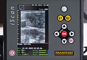 Première 2012 le nouveau échographe avec une sonde linéaire – iScan